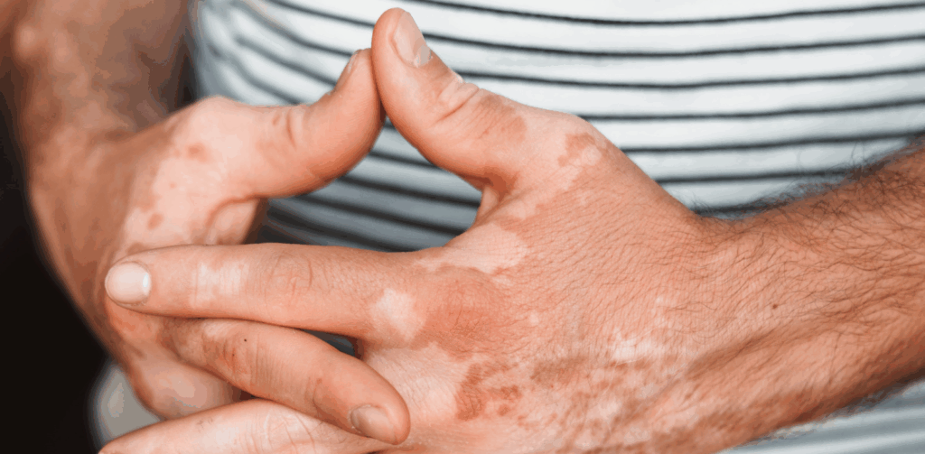 Ny uddelingsstrategi: Årlig støtte øges til mere end 500 millioner kroner fra 2030