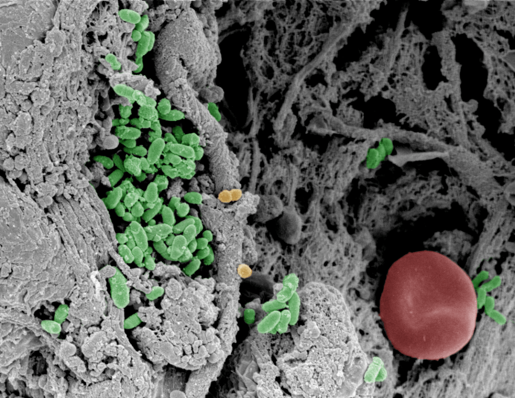 Solving The Puzzle Of Tiny Organisms - Leo Foundation