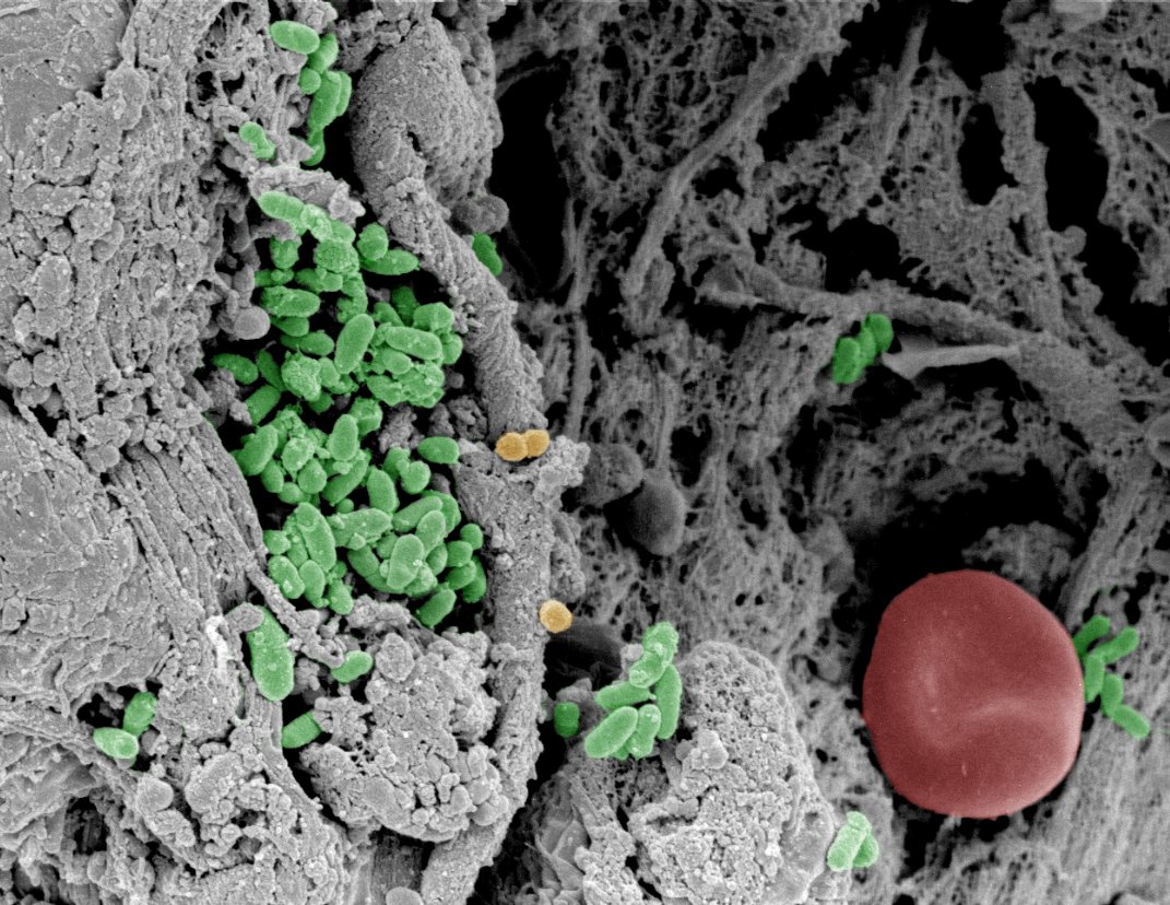 Solving the puzzle of tiny organisms - LEO Foundation